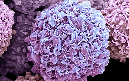 Brustkrebs Kartenbild