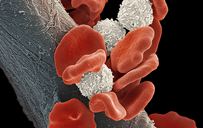 Blutkrebs Kartenbild