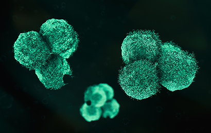 Prostatakrebs Kartenbild